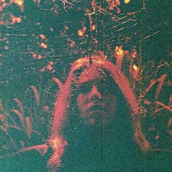 Turnover – Peripheral Vision